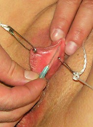 Needles in Clitoris